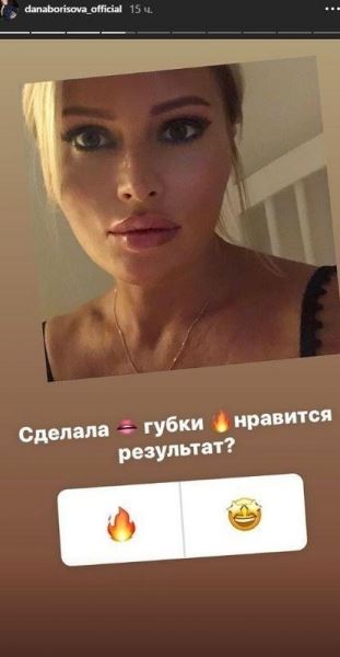 <br />
Дана Борисова «надула» губы?<br />
